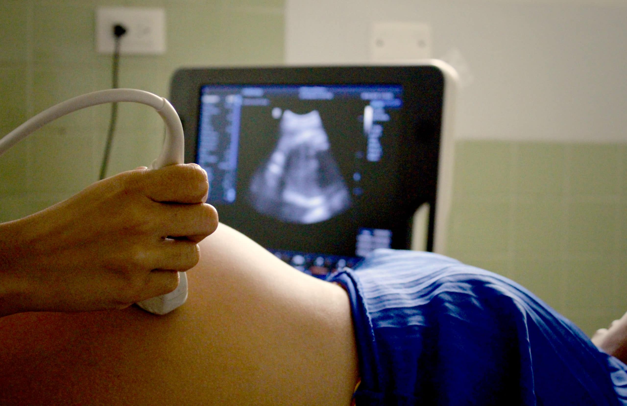 Nærbilde av en stor mage og en skjerm som viser ultralyd