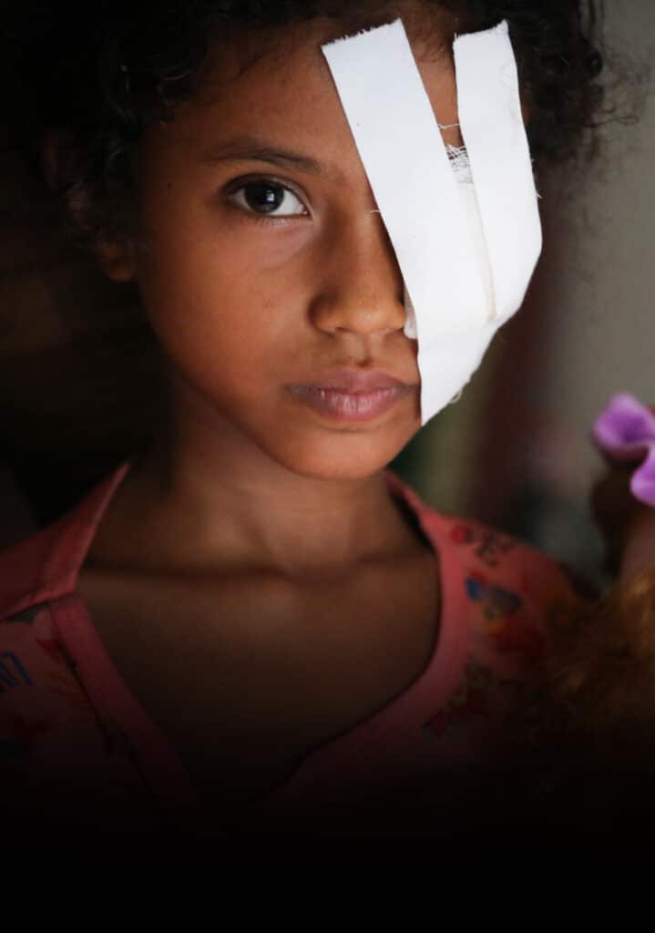 Nærbilde av ei jente som har bandasje over det ene øyet
