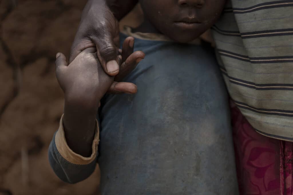 Haken og overkroppen til et afrikansk barn som står tett inntil moren sin. Barnet har på en skitten og slitt blå skjorte.