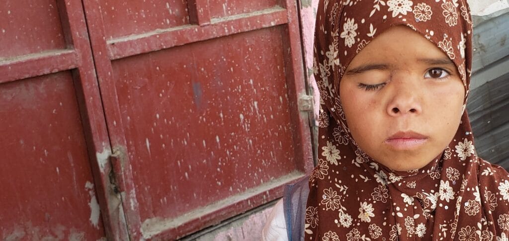 Jente fra Jemen med et tilsynelatende skadet øye.