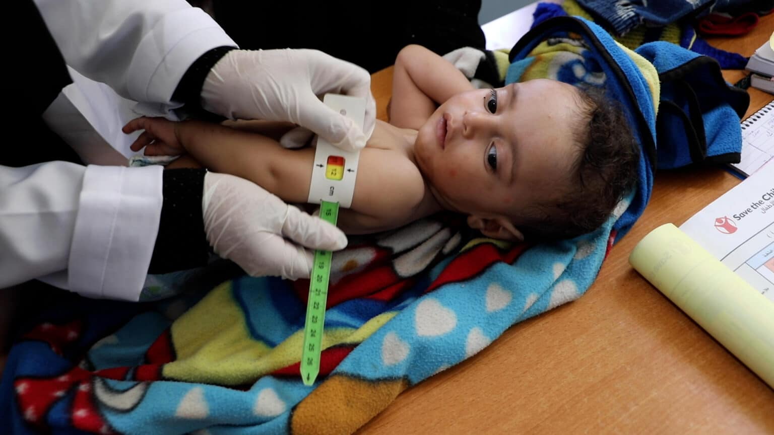 Hjelp barn mot sult og underernæring Redd Barna