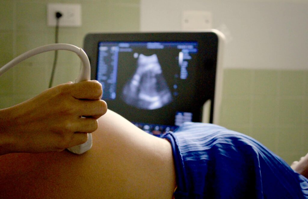 Foto av ultralyd på gravid kvinne.