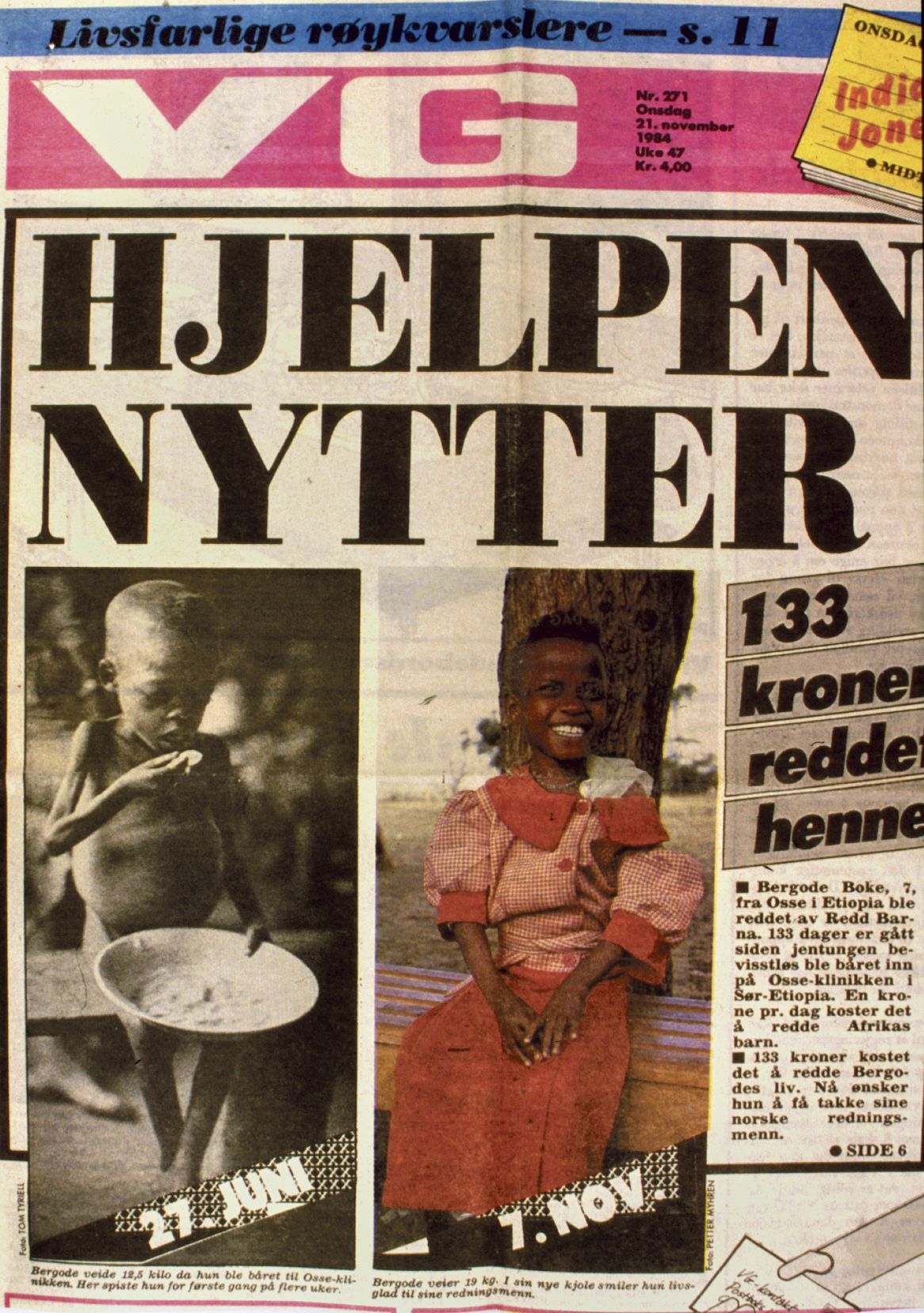 Bilde av en forside av avisen VG i 1984. Tittelen sier «Hjelpen nytter» og vi ser to bilder av samme jente tatt 27. juni hvor hun er svært underernært og et annet fra 7. november hvor hun er frisk og glad.